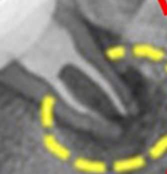 202844_4cfbdb1513.png