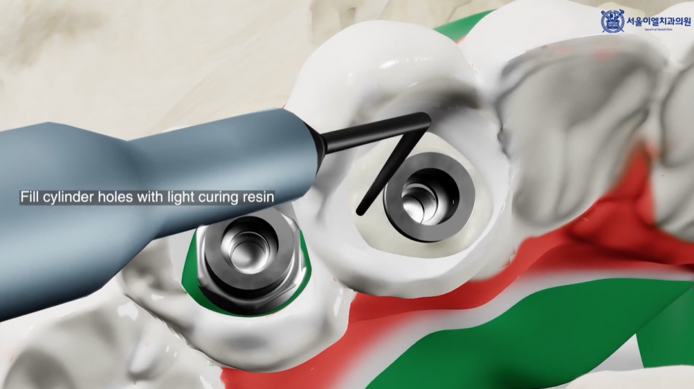 173841_6324ff00b4.png