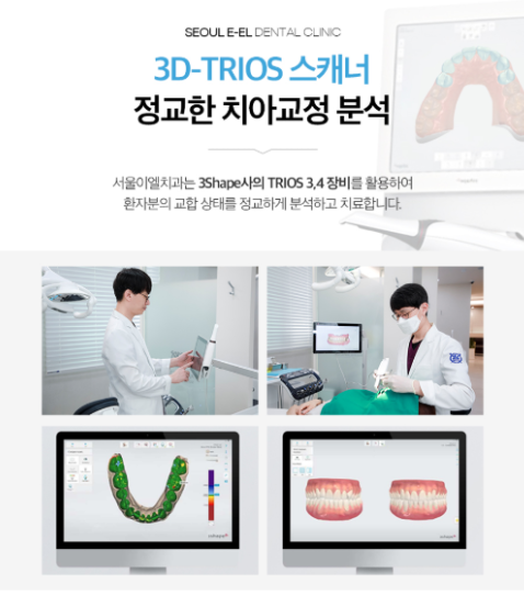 복합 부정교합 상·하악 치열 치료 전 3D 구강스캔 자료
