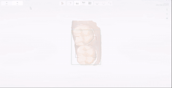 벌어진 치아 상·하악 치열 교정 계획 단계 TRIOS 3D 구강스캔 시뮬레이션 자료