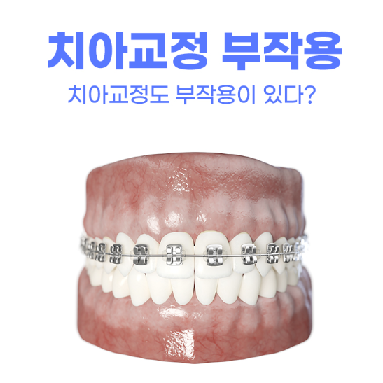 치아교정 부작용 사진