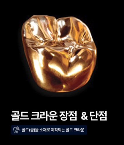 골드 크라운의 예시 사진