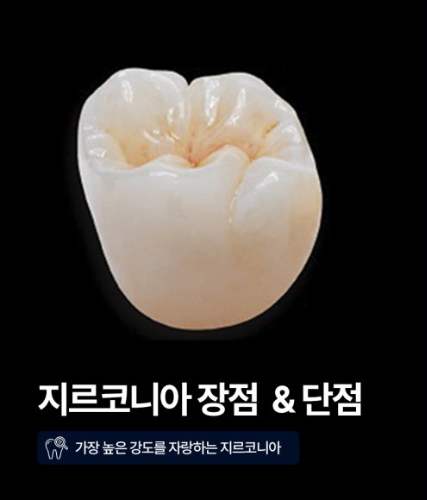 지르코니아 크라운의 예시 사진