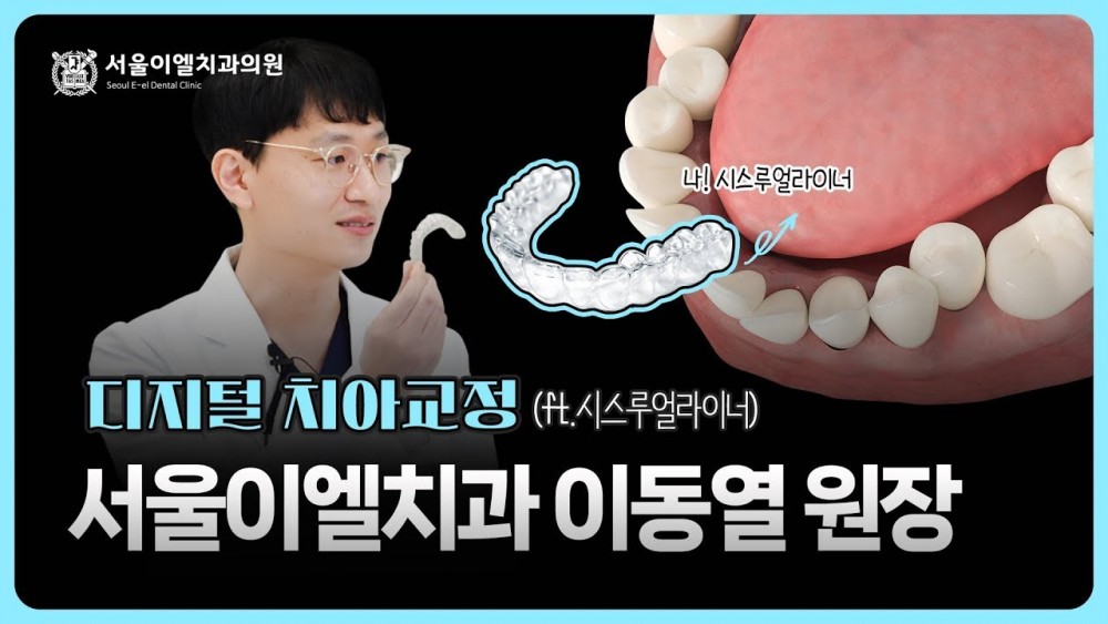 서울이엘치과 디지털 치아교정 시스루 얼라이너 안내 영상 표지