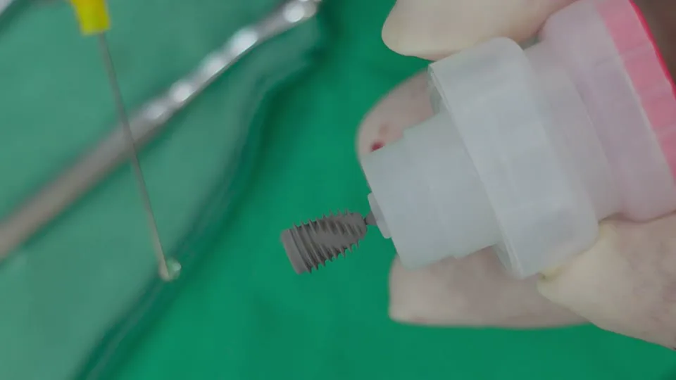 픽스처에 I-PRF를 적용하는 과정 미리보기