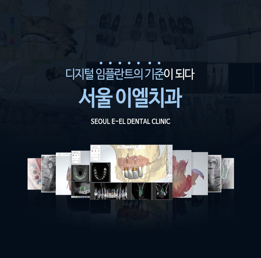 이천 서울이엘치과 디지털 임플란트 안내 이미지 1