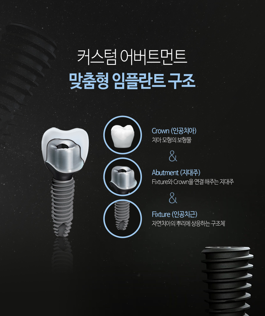 이천 서울이엘치과 디지털 임플란트 안내 이미지 12