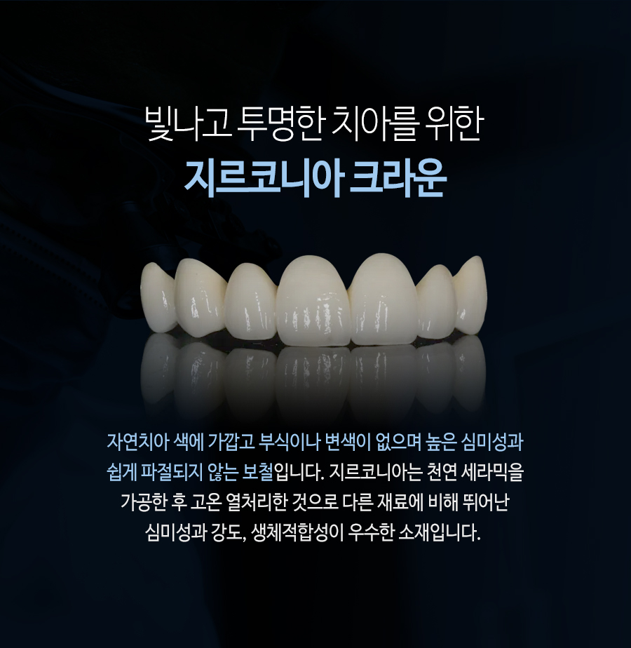 이천 서울이엘치과 디지털 임플란트 안내 이미지 14