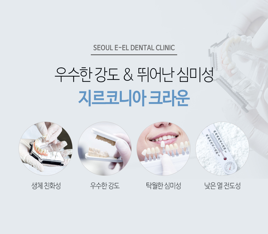 이천 서울이엘치과 디지털 임플란트 안내 이미지 15