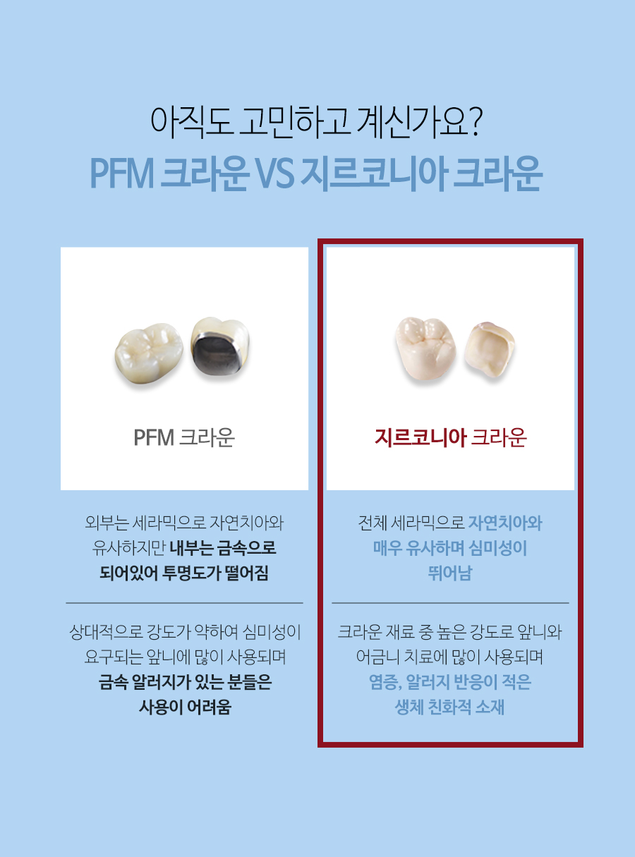이천 서울이엘치과 디지털 임플란트 안내 이미지 16