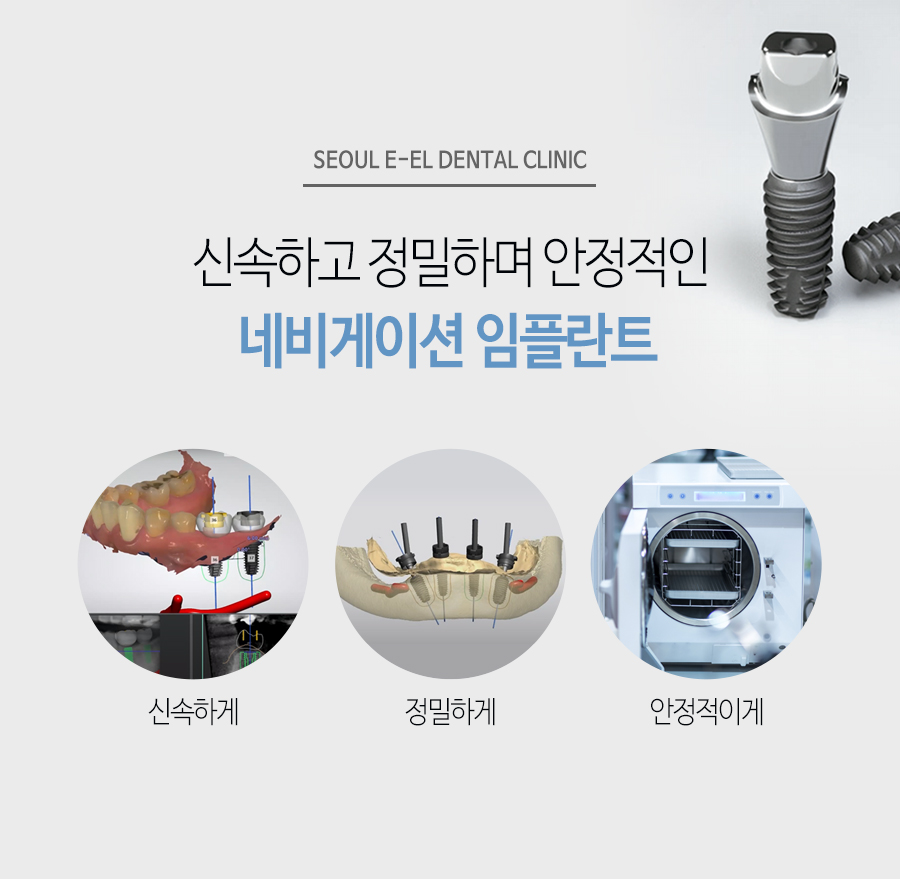 이천 서울이엘치과 디지털 임플란트 안내 이미지 4