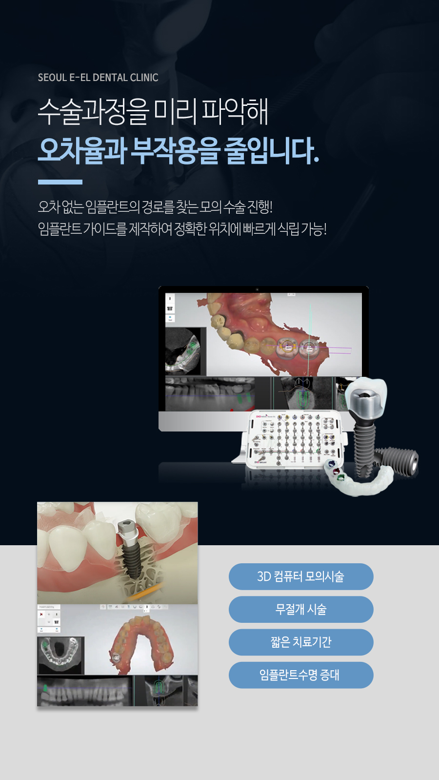 이천 서울이엘치과 디지털 임플란트 안내 이미지 5