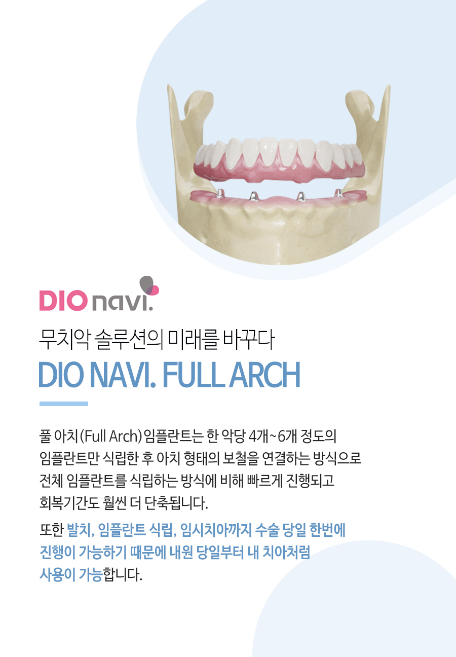 이천 서울이엘치과 디지털 임플란트 안내 이미지 9
