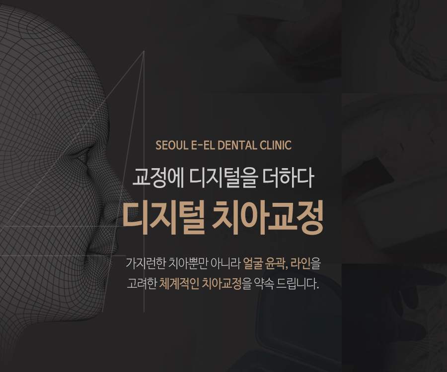 이천 서울이엘치과 디지털 치아교정 안내 이미지 1