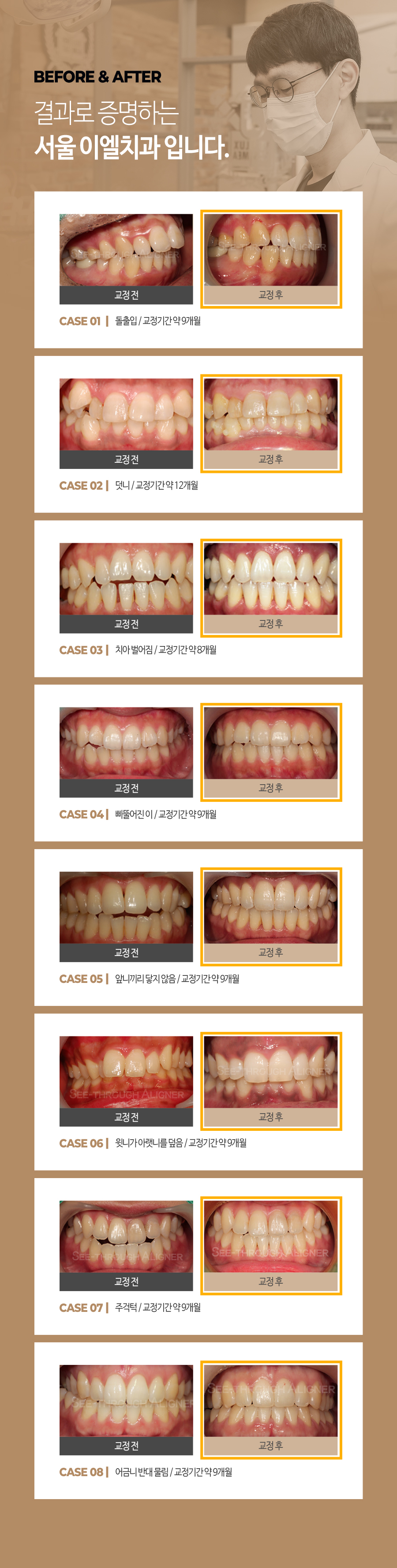 이천 서울이엘치과 디지털 치아교정 안내 이미지 13