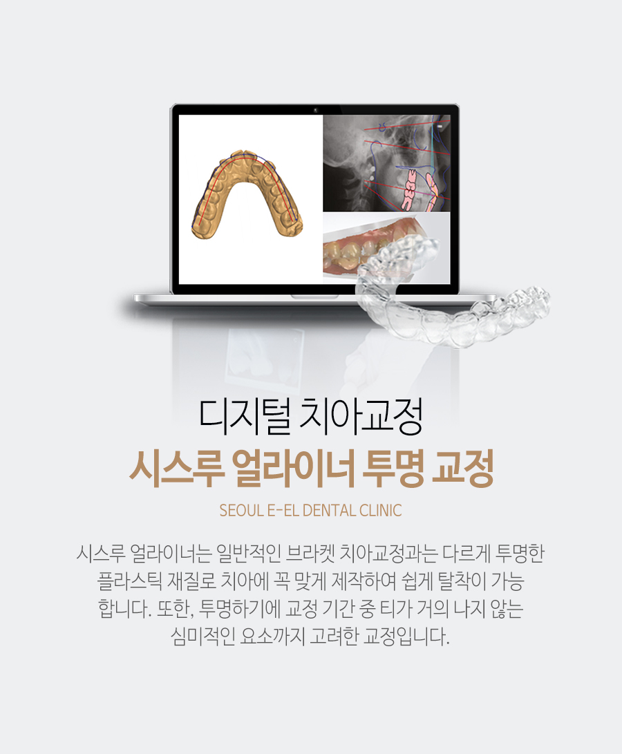 이천 서울이엘치과 디지털 치아교정 안내 이미지 2