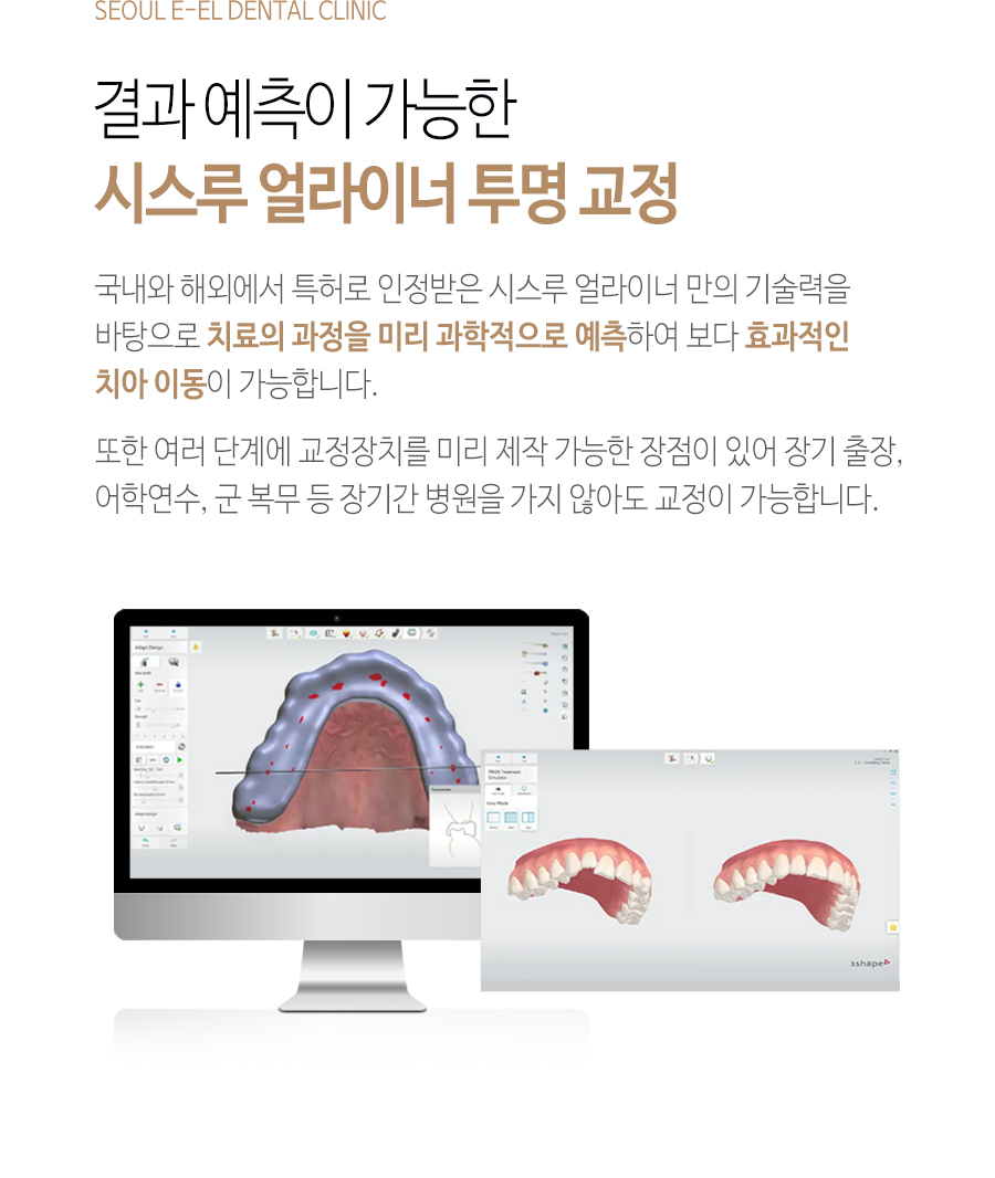 이천 서울이엘치과 디지털 치아교정 안내 이미지 5