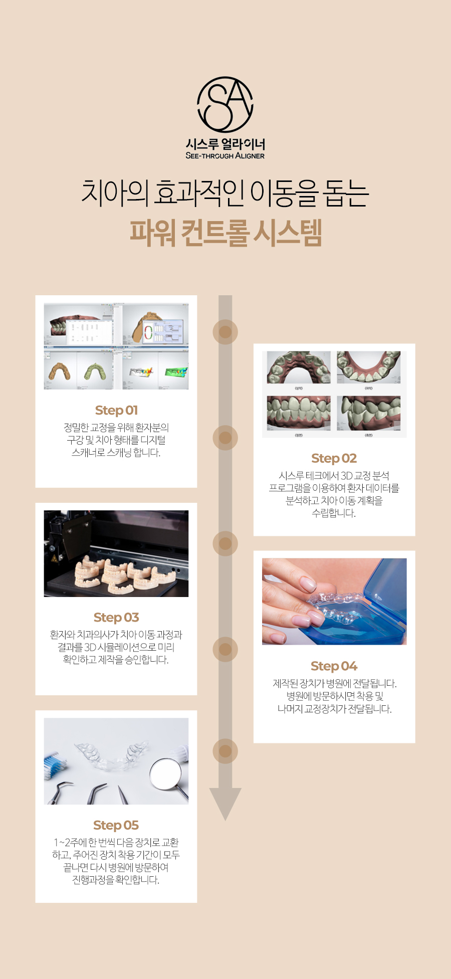 이천 서울이엘치과 디지털 치아교정 안내 이미지 7
