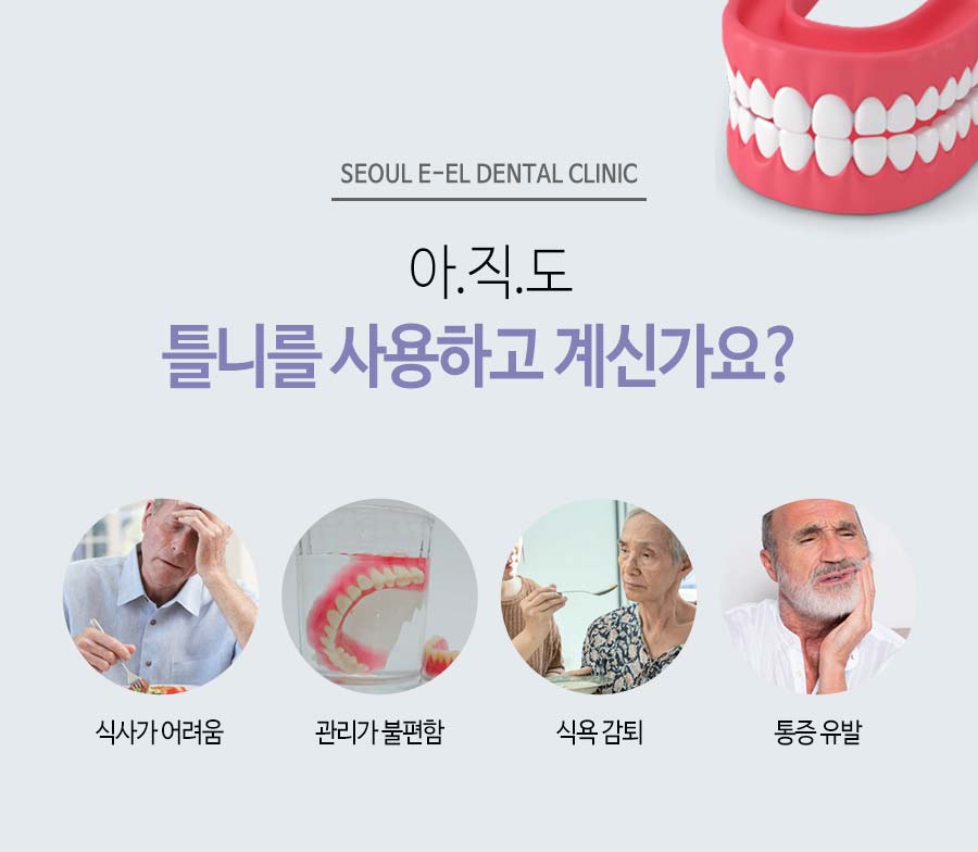 이천 서울이엘치과 풀아치 임플란트 안내 이미지 3