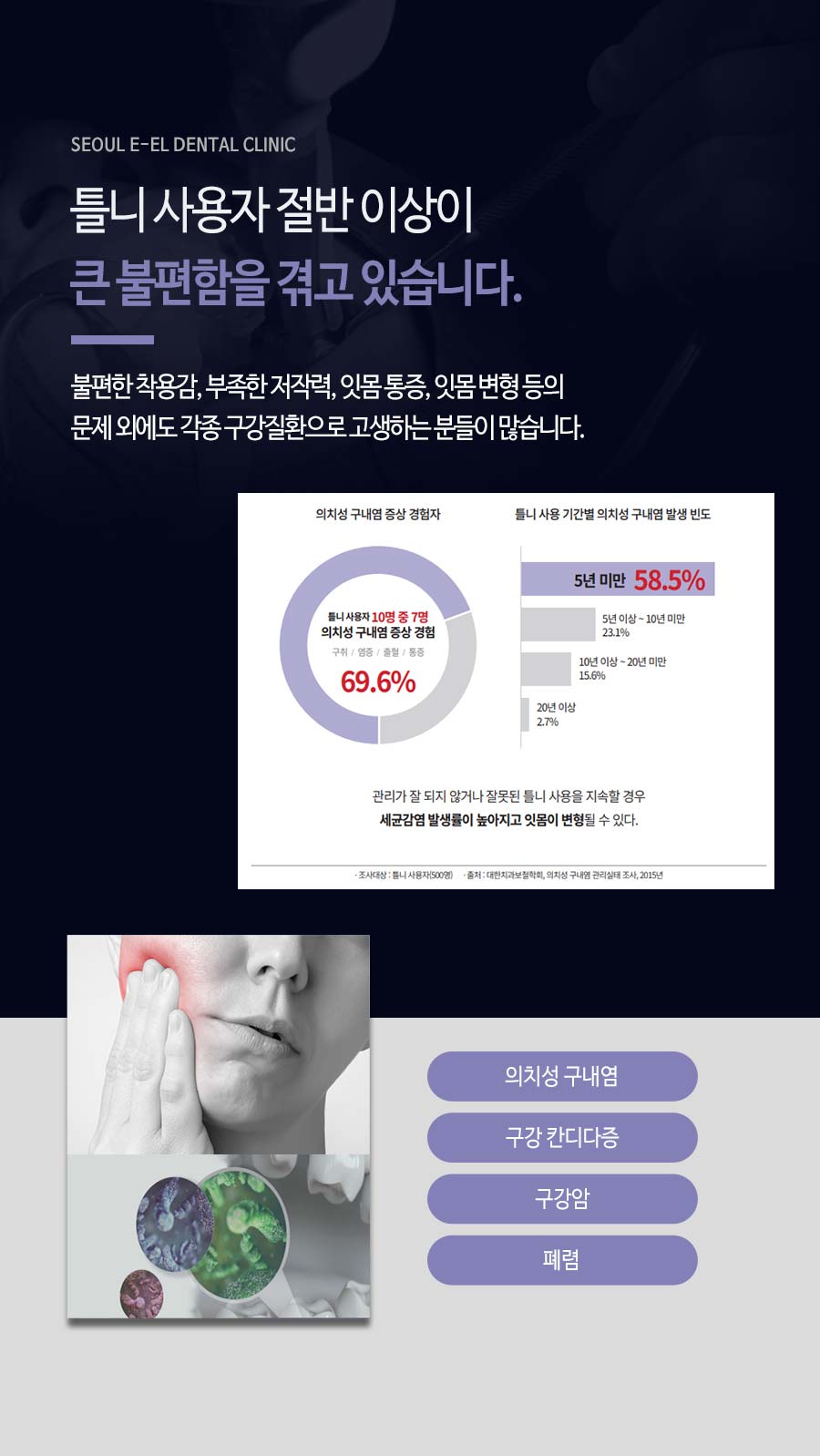 이천 서울이엘치과 풀아치 임플란트 안내 이미지 4
