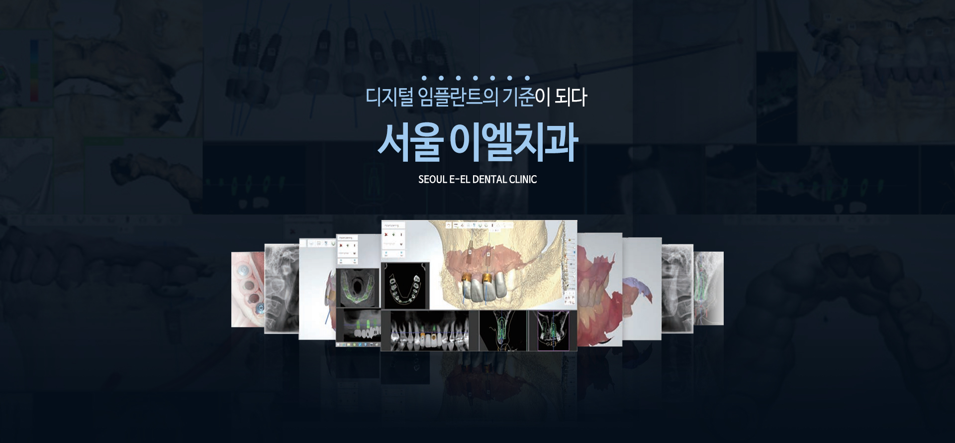 이천 서울이엘치과 디지털 임플란트 안내 이미지 1