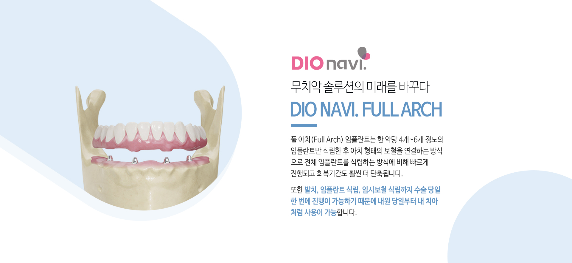 이천 서울이엘치과 디지털 임플란트 안내 이미지 10