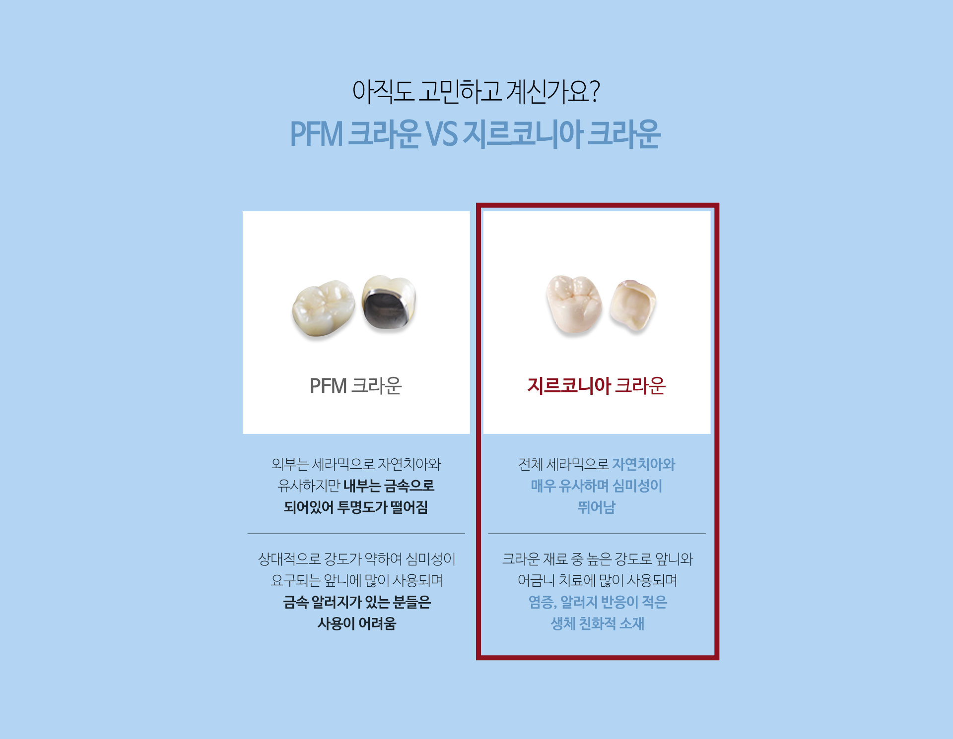 이천 서울이엘치과 디지털 임플란트 안내 이미지 17