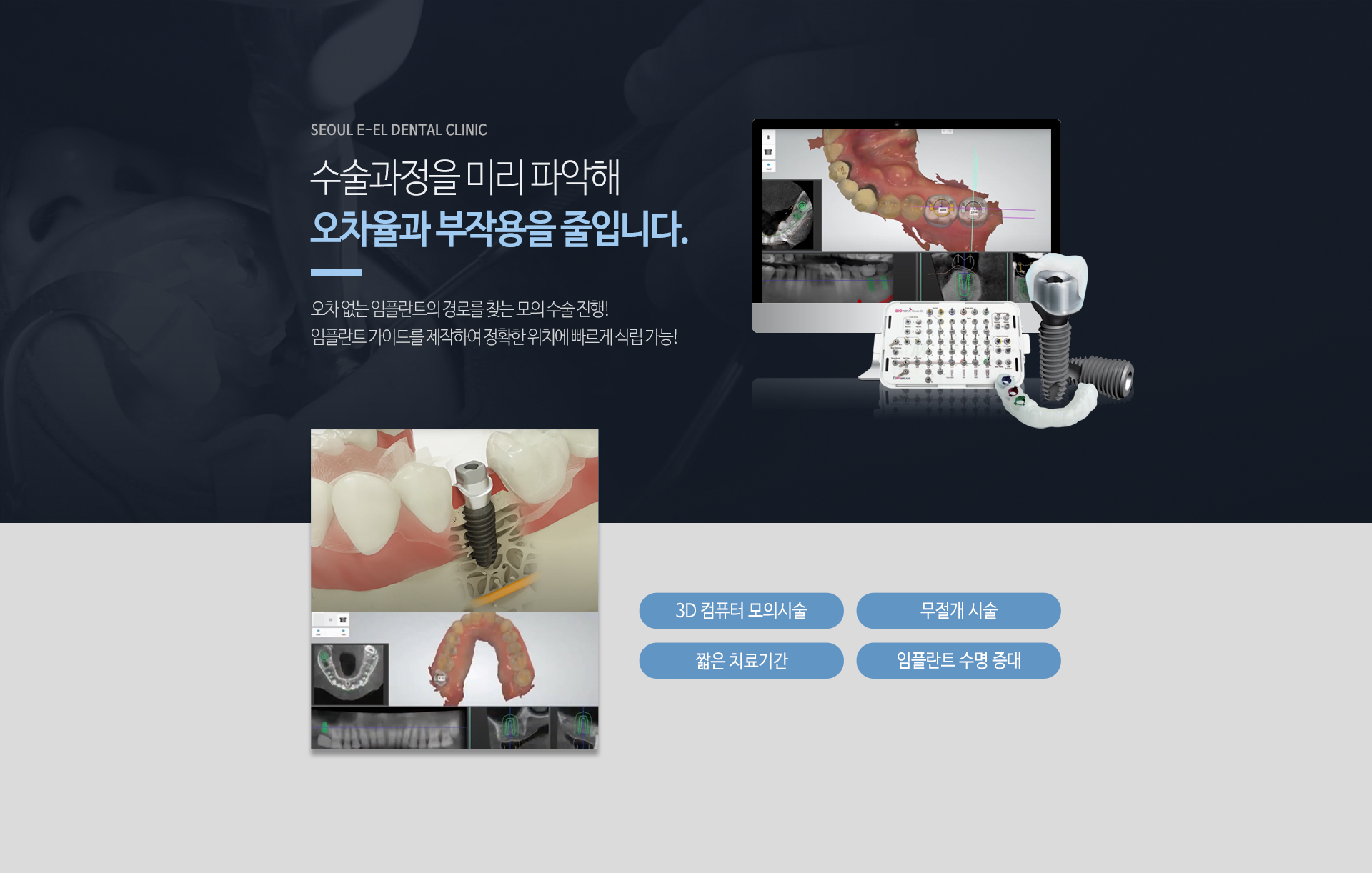 이천 서울이엘치과 디지털 임플란트 안내 이미지 5
