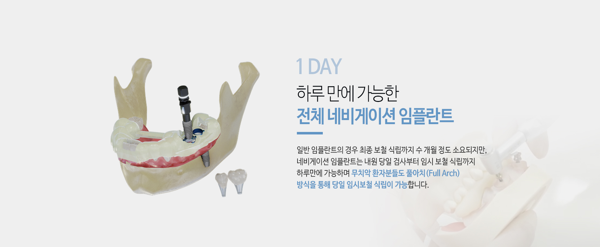 이천 서울이엘치과 디지털 임플란트 안내 이미지 8