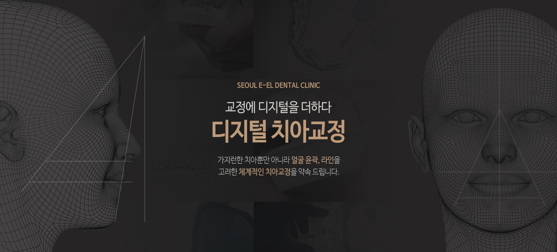 이천 서울이엘치과 디지털 치아교정 안내 이미지 1