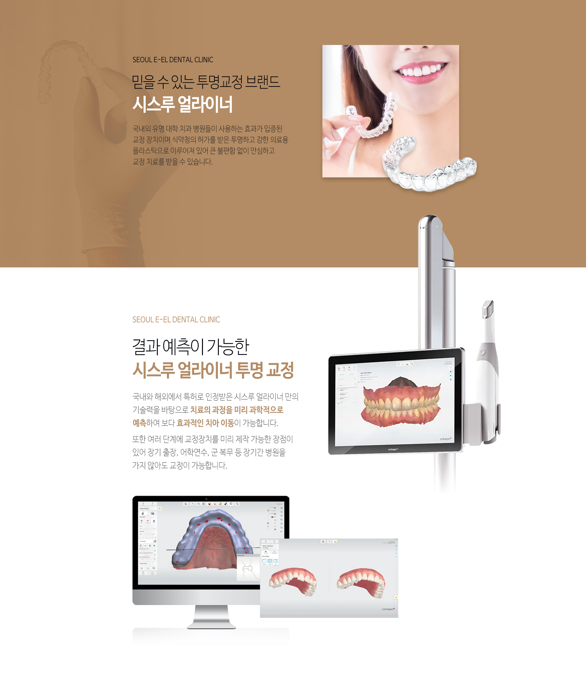 이천 서울이엘치과 디지털 치아교정 안내 이미지 4