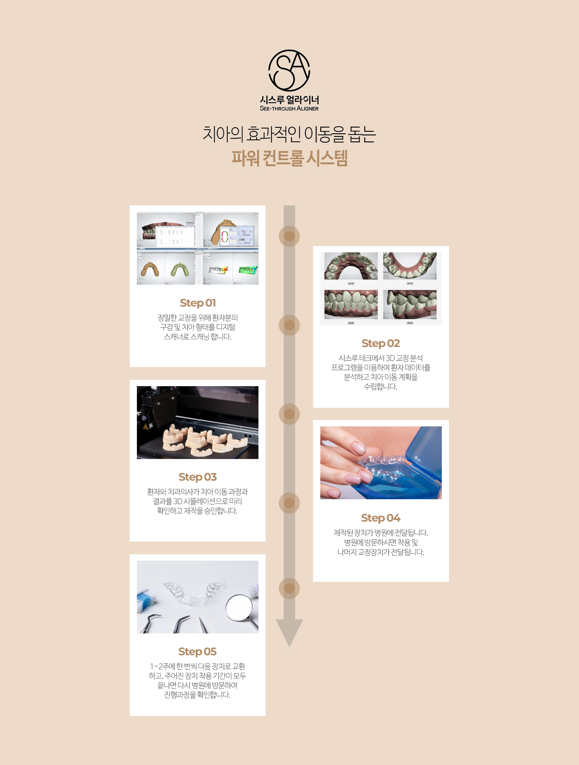 이천 서울이엘치과 디지털 치아교정 안내 이미지 6