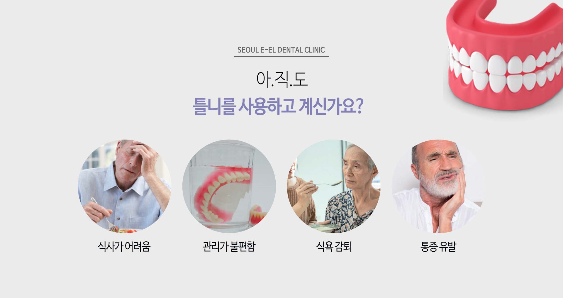 이천 서울이엘치과 풀아치 임플란트 안내 이미지 3