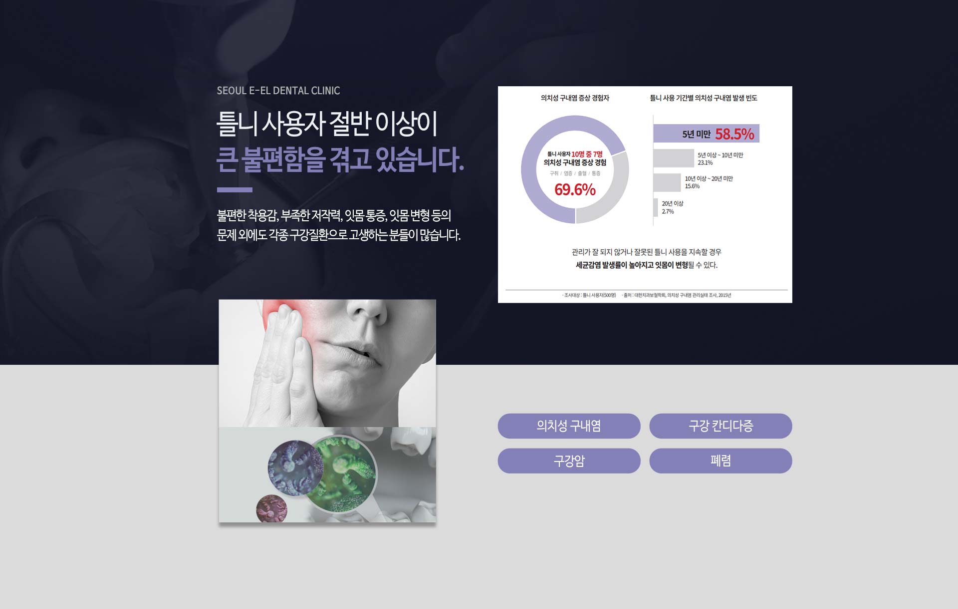 이천 서울이엘치과 풀아치 임플란트 안내 이미지 4