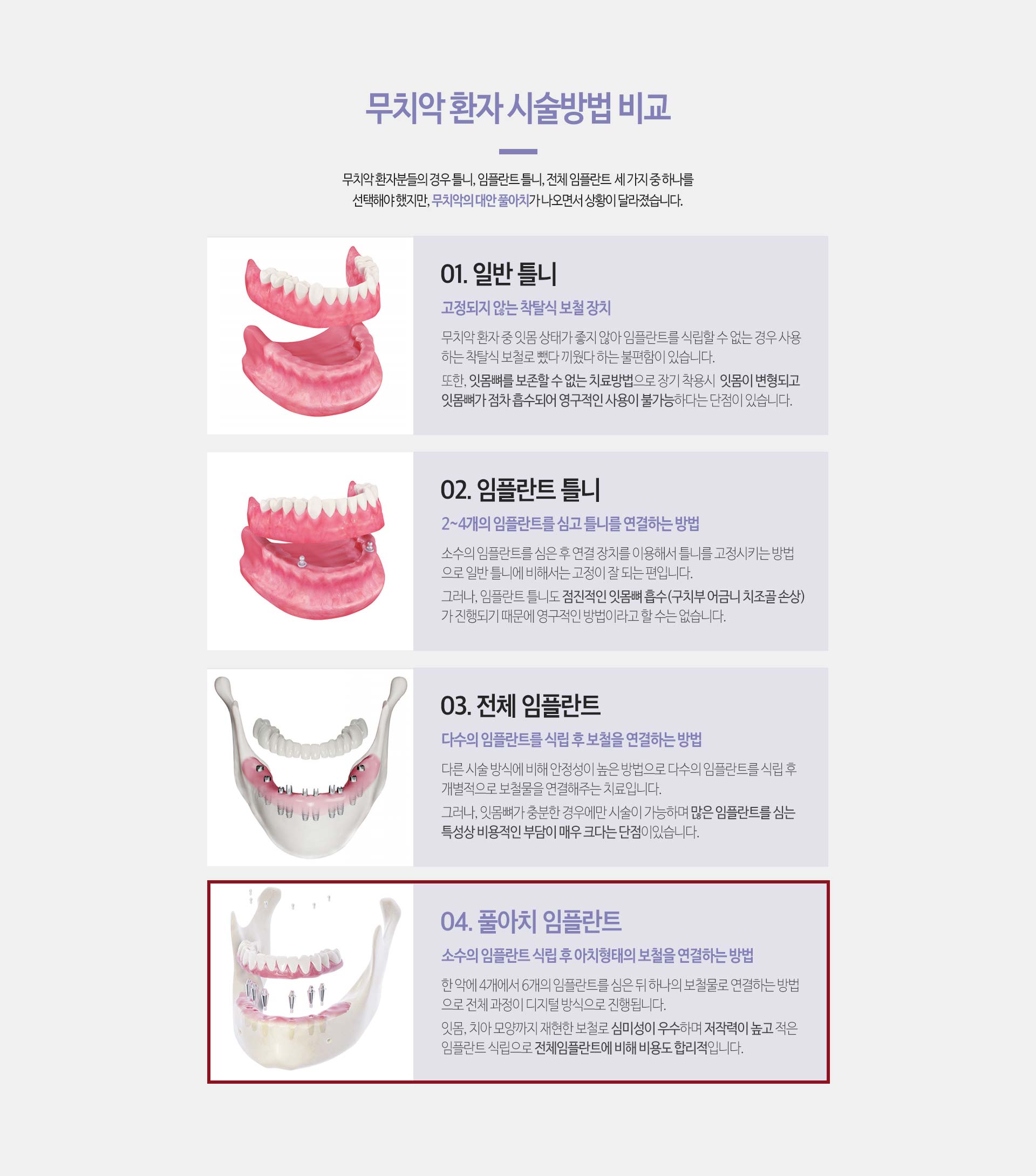 이천 서울이엘치과 풀아치 임플란트 안내 이미지 5